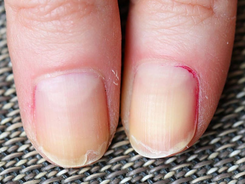 যদি তবুও নখ দ্রুত বাড়ে এবং প্রতি সপ্তাহে বা তারও বেশি বার কাটার প্রয়োজন হয়, তাহলে ধরে নেওয়া যায় যে গুরুত্বপূর্ণ অঙ্গগুলো সুস্থ ও কার্যক্ষম আছে, যা আয়ু বাড়াতে সহায়ক হতে পারে।