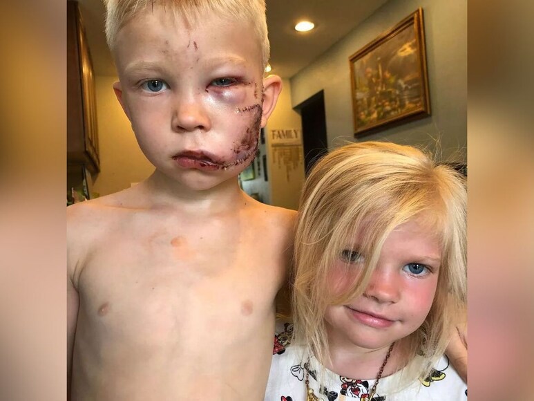 6 साल के भाई ने बचाई बहन की जान