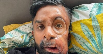 अमित अपनी जिंदगी में खुश हैं, लेकिन लोगों के तानों से कई बार परेशान हो जाते हैं. (Photo- Social Media)