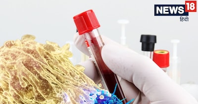 Revolutionary Blood Test Detects 70 Cancers Early, Life-Saver for Over 40s