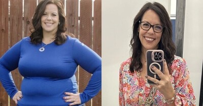 चीनी की लत से मौत के कगार पर पहुंची महिला, मीठा छोड़कर 45 किलो वजन घटाया!