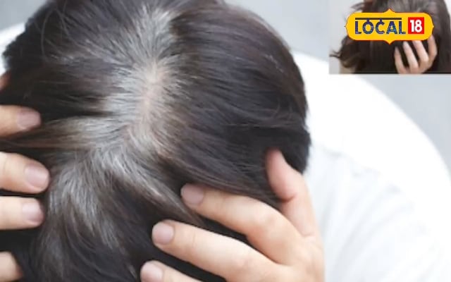 बाली उमर में सफेद हो रहे बाल यह घरेलू नुस्खा दिलाएगा आराम! 5 चीजों से तैयार हफ्ते में एक बार करें इस्तेमाल