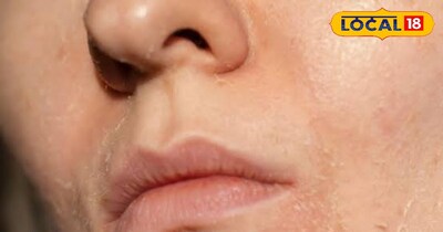 ड्राइनेस