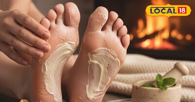 सर्दियों में फटी एड़ियों का जादू...मूंगफली छिलका.