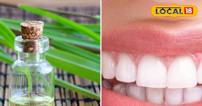 ओरल हाइजीन के लिए लौंग का तेल और नींबू घास बन सकते हैं सुरक्षित विकल्प