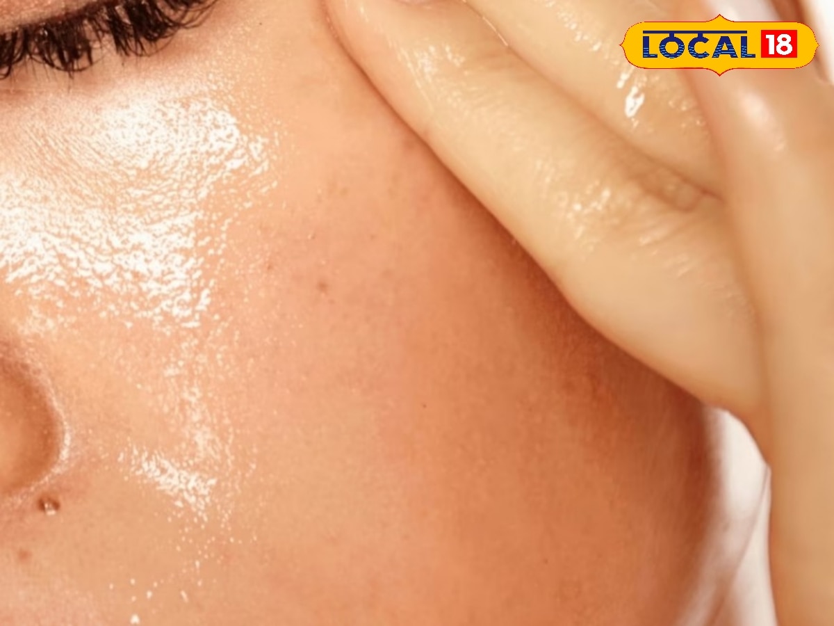 कितनी भी केयर करें चेहरे से टपकता है तेल लग रहती पिंपल्स की दुकान ऑयली स्किन को चाहिए कुछ एक्स्ट्रा ये आजमाएं