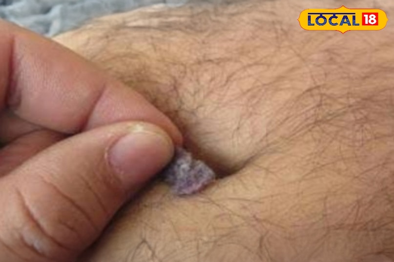 पसीना और गंदगी कैसे बनाते हैं नाभि में रुई