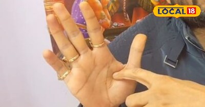 हाथ की मुठ्ठी में तिल खोल देगा किस्मत