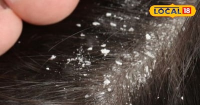 बालों की देखभाल