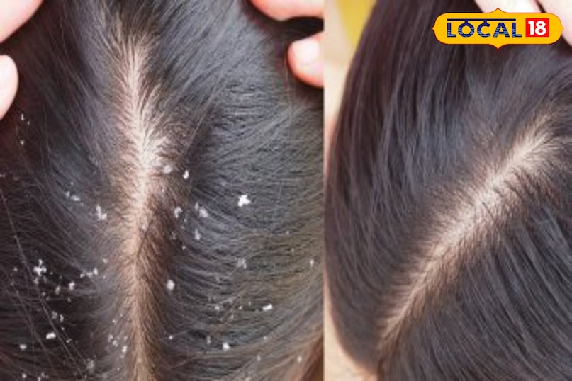 बालों की देखभाल 