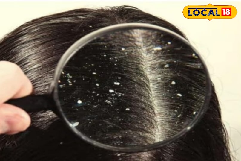 बालों की देखभाल 