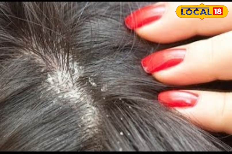 बालों की देखभाल 