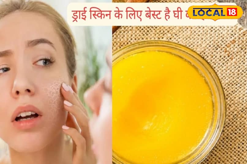 ब्यूटी टिप्स 