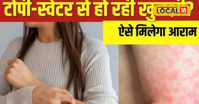 ऊनी कपड़ों से नहीं होगा खुजलाहट, जाने घरेलू उपाय 