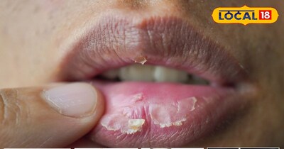 लिप्स टिप्स 