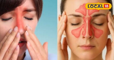 सर्दियों में साइनस से परेशान लोग अपनाएं ये आयुर्वेदिक टिप्स 