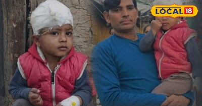 Ghaziabad: 4-Year-Old Mauled by Stray Dogs in Kanawani, Suffers 30 Stitches