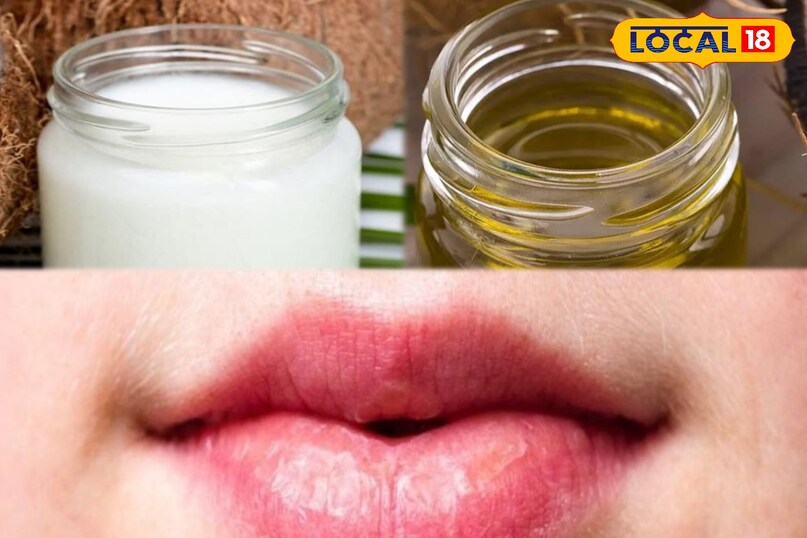 पीढ़ियों से आज़माया गया देसी फॉर्मूला: सर्दियों में फटे होंठों का रामबाण इलाज...