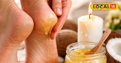 सर्दियों में एड़ियां ज्यादा फटती हैं.