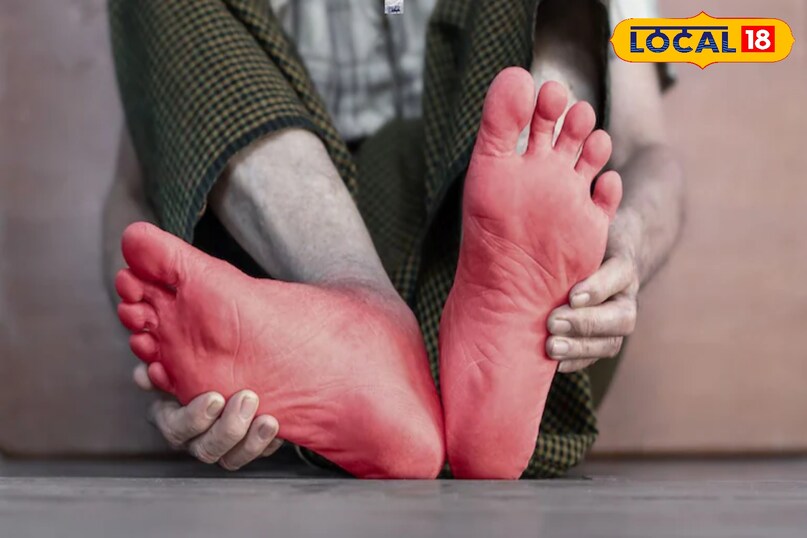 বারবার এমন হলে তা ক্ষত হয়ে যায়।