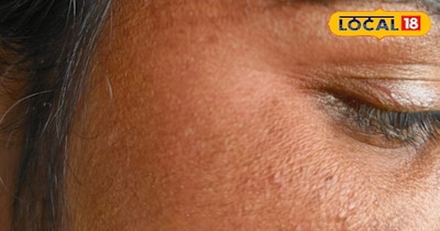 ब्यूटी टिप्स 