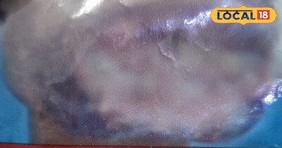 ताबकू के सेवन से आपका शरीर हो रहा है डैमेज 