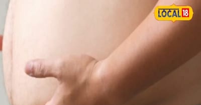 चर्बी का इलाज