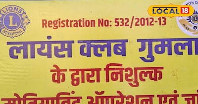 गुमला में कल होगा आंखों की विभिन्न बिमारियों का निःशुल्क इलाज एवं 3 फरवरी को निः