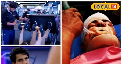 सर पर 42 टांके, गर्दन टूटी, कई दिन तक रहा कोमा में, डाक्टरों ने कहा नहीं बचेगा,