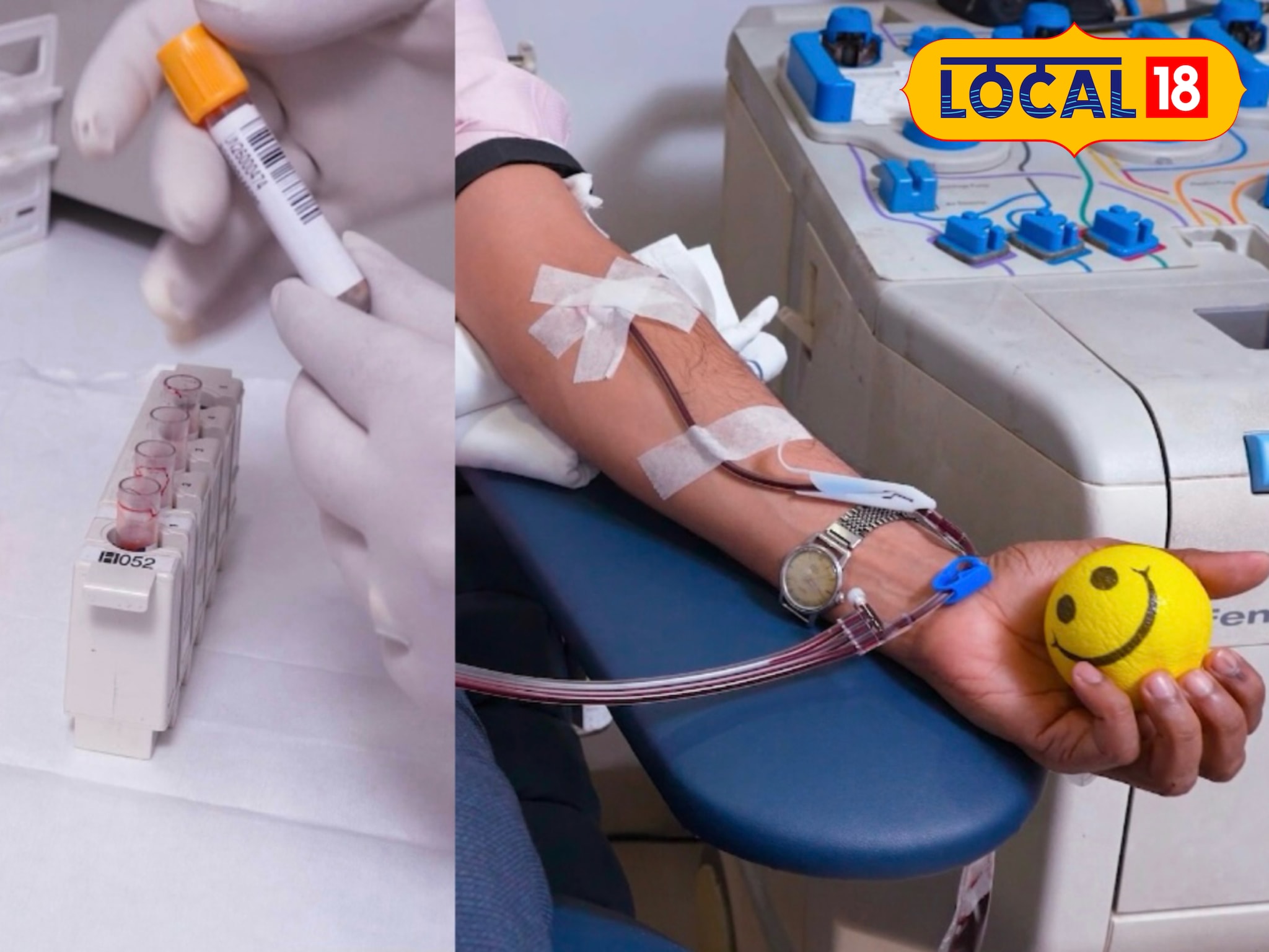 ब्लड डोनेशन से पहले और बाद में भूलकर भी न करें ये गलतियां, विशेषज्ञ ने बताए जरूरी टिप्स