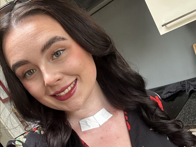 महिला के गले में दर्द था, जब वह डॉक्टरों के पास गई तो उन्होंने कहा कि मामूली दर्द है, लेकिन फिर...