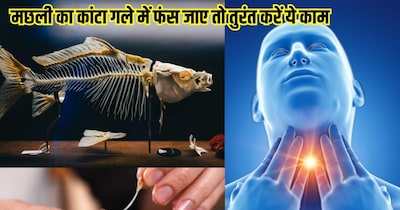 मछली का कांटा गले से निकालने के नुस्खे.