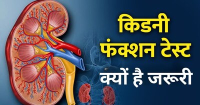 किडनी फंक्शन टेस्ट. 
