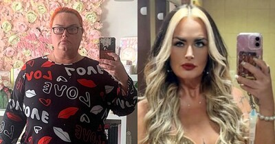 Woman Spends 2.2 Million on Surgery, Fails to Lose Weight; 1500 Rupee Injection Transforms Her