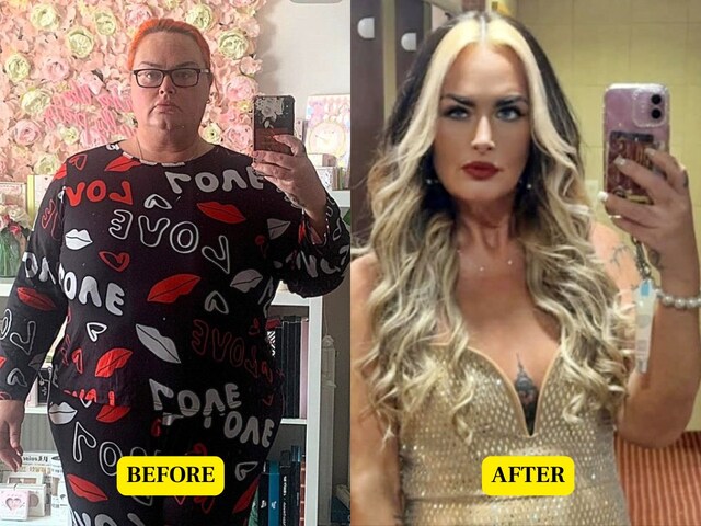 सर्जरी पर खर्च किए 22 लाख, लेकिन नहीं घटा वजन, 1500 रुपए के इंजेक्शन ने बदल दी सूरत!