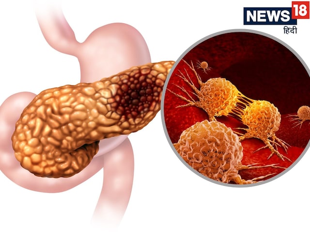 Cure for the deadliest cancer found? Spanish scientist made a shocking discovery