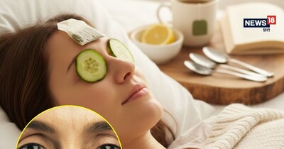 ठंडे खीरे के स्लाइस न केवल सूजन कम करते हैं, बल्कि आँखों के आसपास के काले घेरों (Dark Circles) को भी हल्का करते हैं.