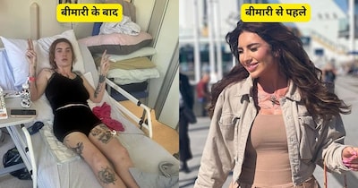 दुर्लभ बीमारी ने महिला को किया 'कैद': रेबेका ने जीती लकवे से जंग.