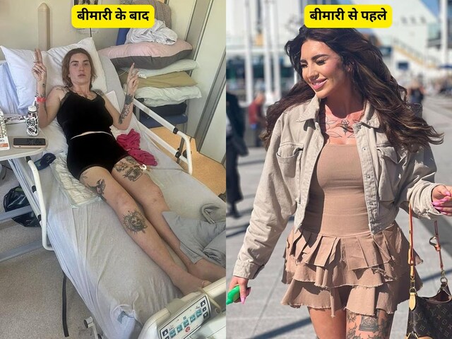 अपने ही शरीर में 'कैद' हुई महिला, अचानक शरीर ने छोड़ा साथ, न हाथ और न ही पैर हिल सके