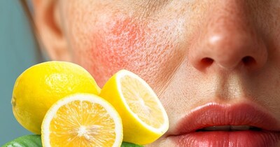 नींबू से चेहरे को नुकसान: इन 4 गलतियों से बचें, त्वचा रहेगी सुरक्षित.