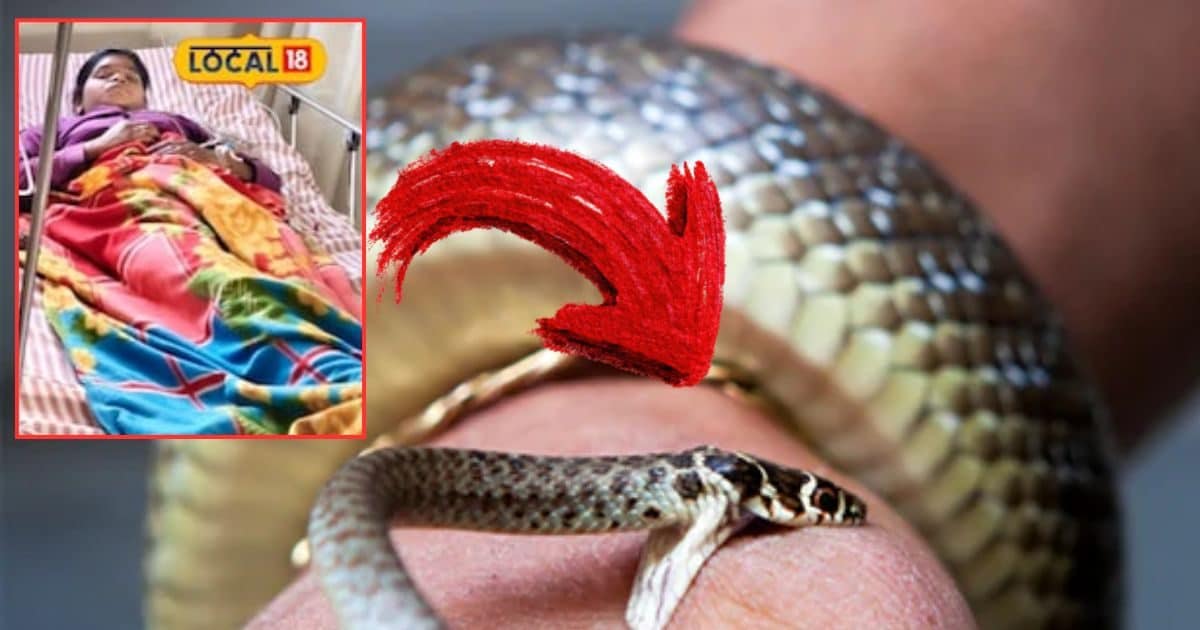 Snake Bite: उम्र 15 साल और 3 महीने में 7 बार सांप ने डंसा, पर मौत छू भी नहीं सकी