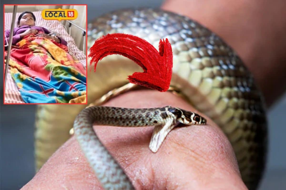 Snake Bite: उम्र 15 साल और 3 महीने में 7 बार सांप ने डंसा पर मौत छू भी नहीं सकी