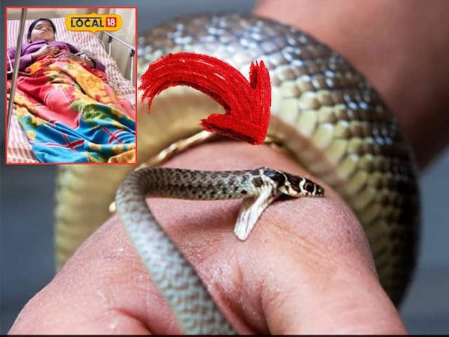 उम्र 15 साल और 3 महीने में 7 बार सांप ने डंसा, पर मौत छू भी नहीं सकी