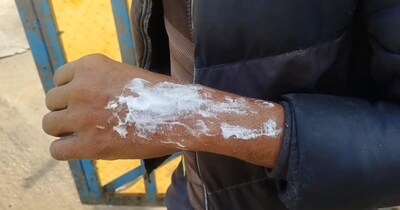 Panipat Transformer Blast: 11 Injured, Wall Collapses at Poultry Farm