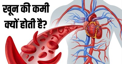 पुरुषों में आयरन की कमी और विटामिन B12 की कमी से एनीमिया हो सकता है.