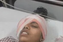 दिल्ली-मेरठ मार्ग पर गड्ढों से भरी पुलिया पर फिसली स्कूटी, भाई-बहन घायल