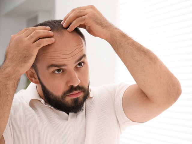 16वीं सदी में बाल बढ़ाने के लिए अपनाई जाती थी घिनौनी तरकीब, सिर पर लगाते थे ऐसी चीज!