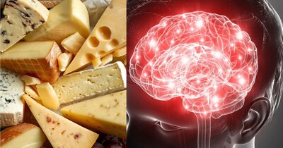 25 साल की स्टडी का खुलासा: हाई-फैट चीज़ से कम हो सकता है डिमेंशिया का खतरा.