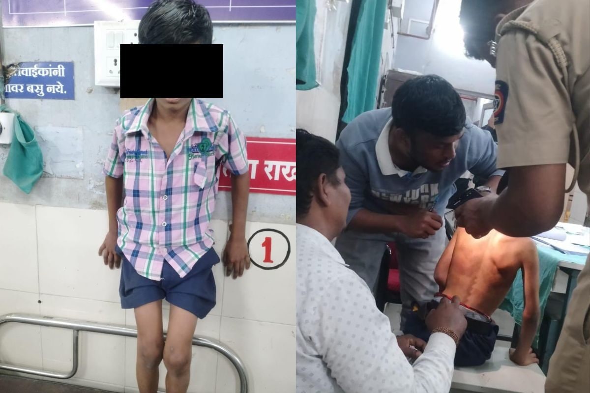 इधर गिनती न लिखने पर बाप ने बेटे को मारा, उधर होमवर्क न करने पर टीचर ने बच्चे की पीठ उधेड़ी, मर रहा बचपन!