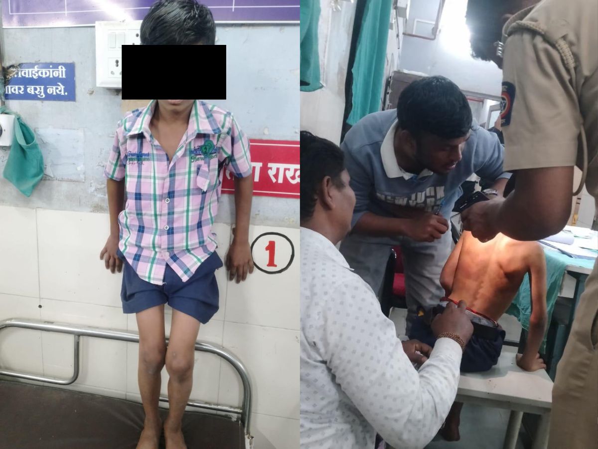 महाराष्ट्र: बुलढाणा में चौथी के छात्र की बेरहमी से पिटाई